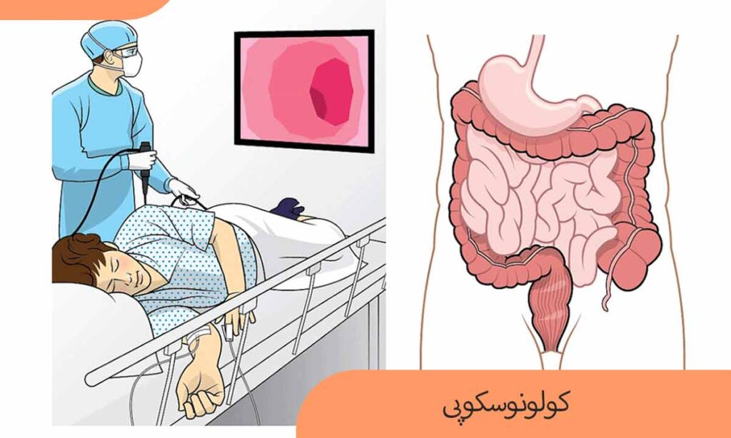 فیلم عمل /جراحی کولونوسکوپی