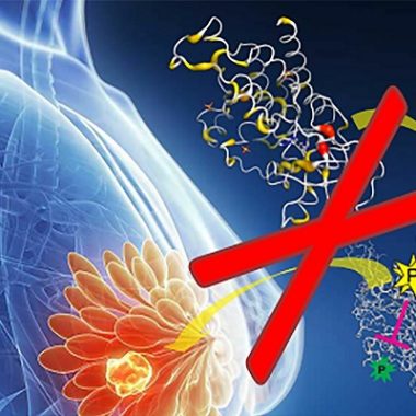 بررسی پستان ها برای تشخیص سرطان سینه - معاینه شخص توسط خودش