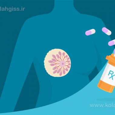 داروی تاموکسیفن برای درمان سرطان سینه