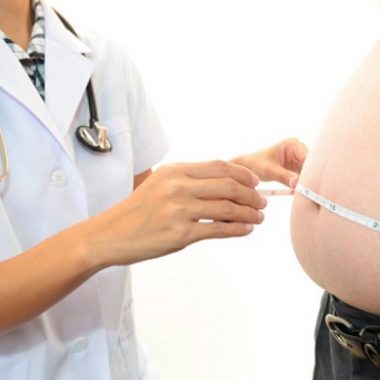 رابطه چاقی و سرطان تخمدان - شاخص توده بدنی (BMI) - سیگار کشیدن