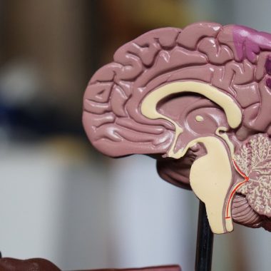سرطان مغز چیست و از علائم و روش های درمانی آنچه می دانید؟