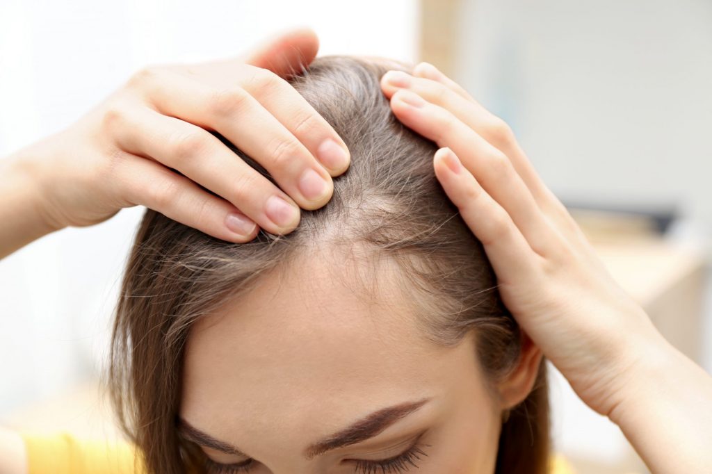 بهترین راههای درمان ریزش مو و تشخیص علت ریزش مو کدامند؟