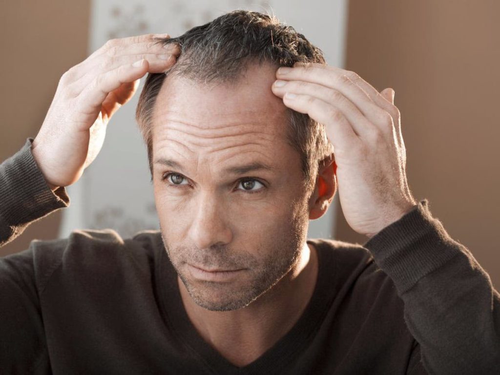 آشنایی با روش های بسیار موثر در پیشگیری از ریزش مو