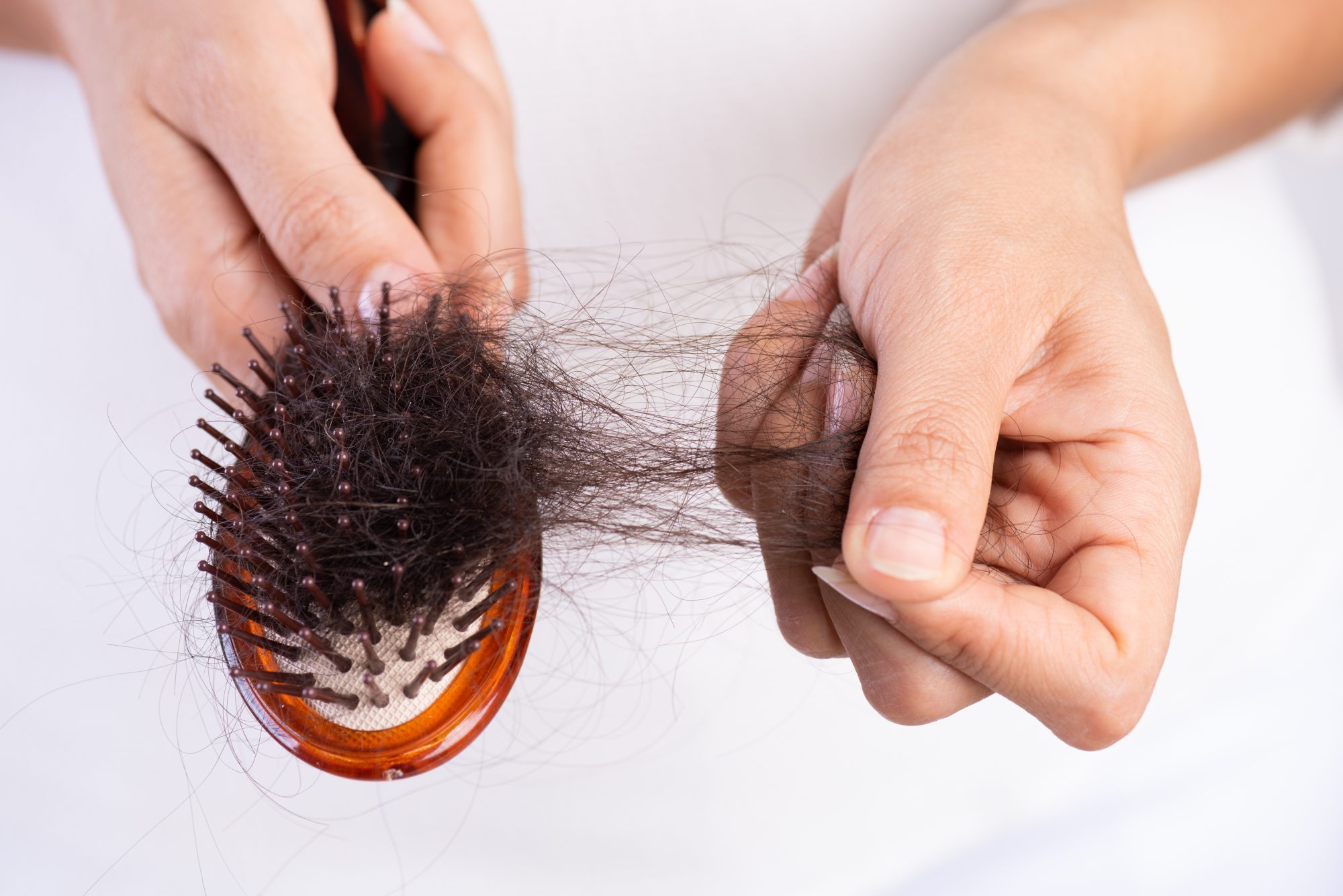 نقش بیماری ها در ریزش مو چیست و چگونه درمان می شود؟