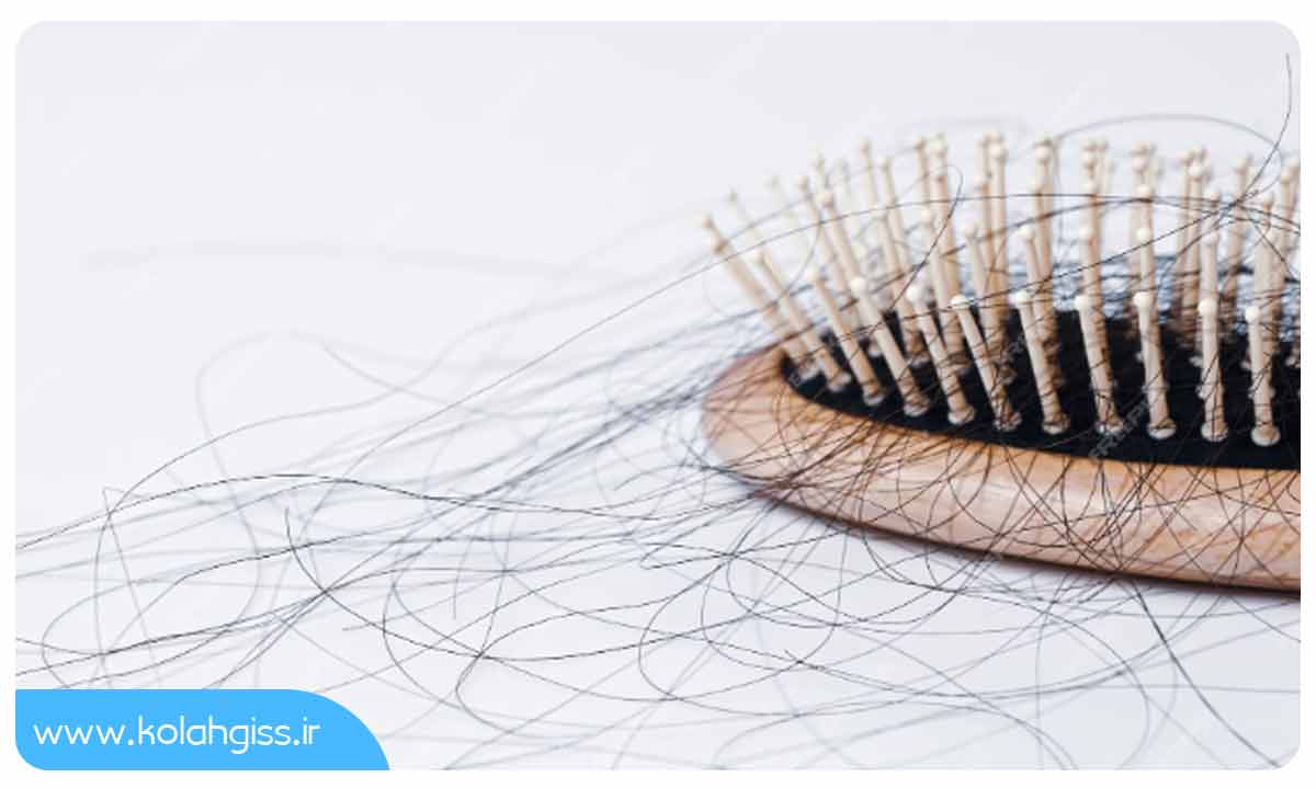 چه چیزی موجب ریزش موی فصلی می شود؟