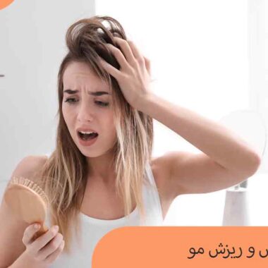 رابطه استرس و ریزش مو