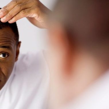 علت ریزش موی ناگهانی چیست و چگونه می توان از آن جلوگیری کرد؟