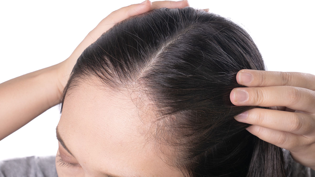 اثرات کمبود مواد مغذی بر روی رشد مو یا ریزش موها چیست؟