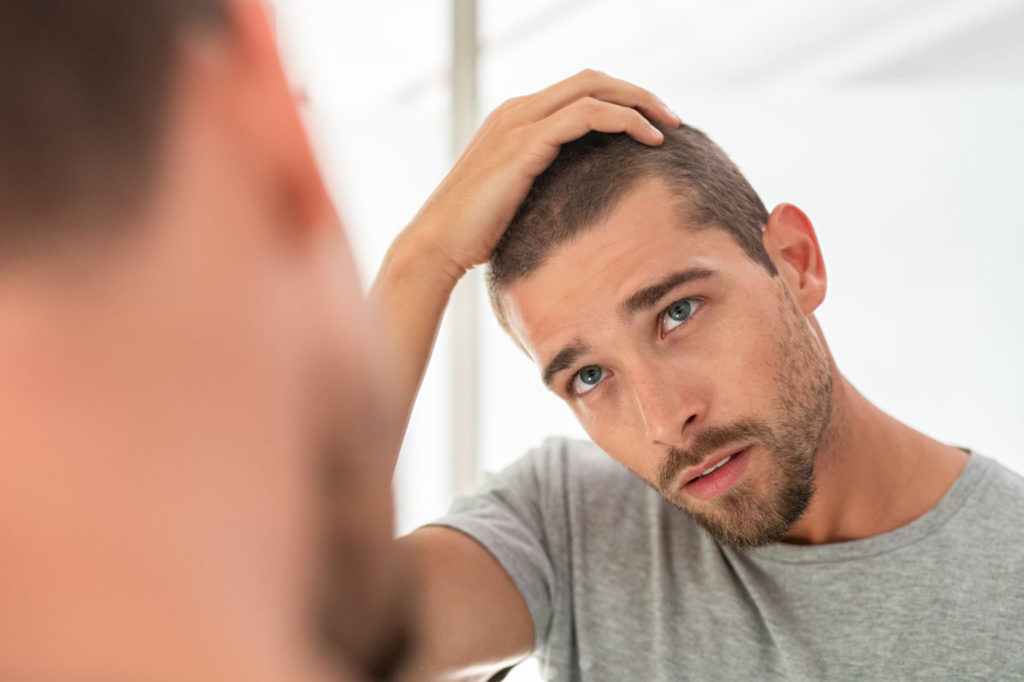 تلوژن افلوویوم چیست؟ علائم، علل و روش های درمان این نوع ریزش مو تلوژن افلوویوم چیست؟ علائم، علل و روش های درمان این نوع ریزش مو