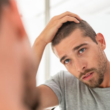 تلوژن افلوویوم چیست؟ علائم، علل و روش های درمان این نوع ریزش مو
