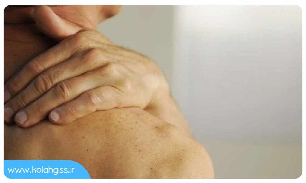 سارکوم چیست؟