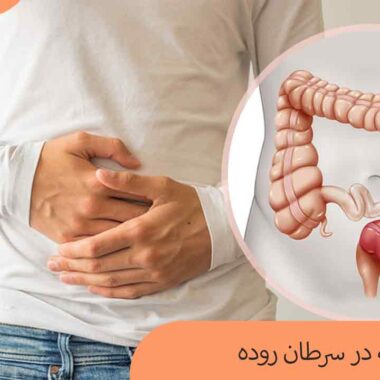 نقش تغذیه در سرطان روده