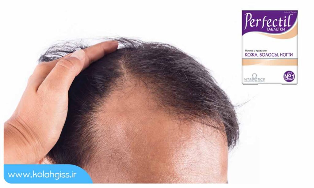 مصرف قرص پرفکتیل پلاتینیوم برای جلوگیری از ریزش مو