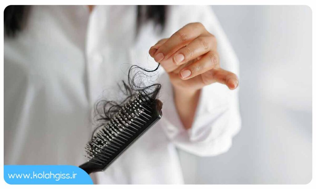 درمان ریزش مو در بارداری