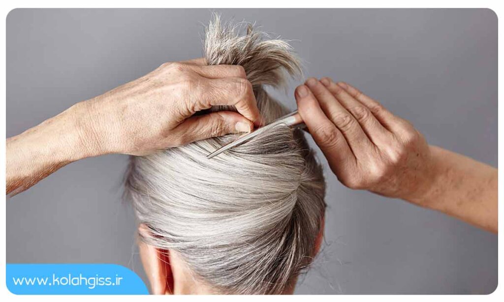 راه های درمان ریزش مو در یائسگی