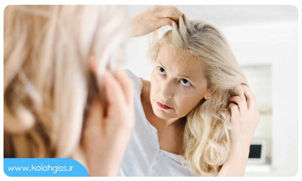روش های پیشرفته در درمان ریزش مو در دوران یائسگی
