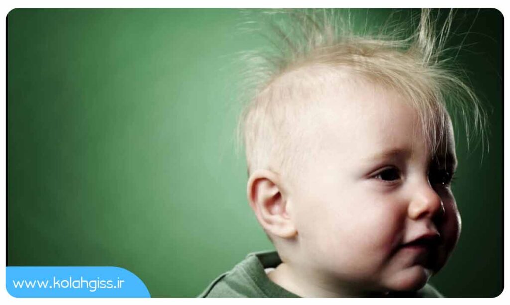 علل غیر معمول ریزش مو در کودکان چیست؟